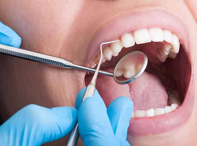 Closeup of a dentist’s gloved fingers scraping plaque off someone’s teeth